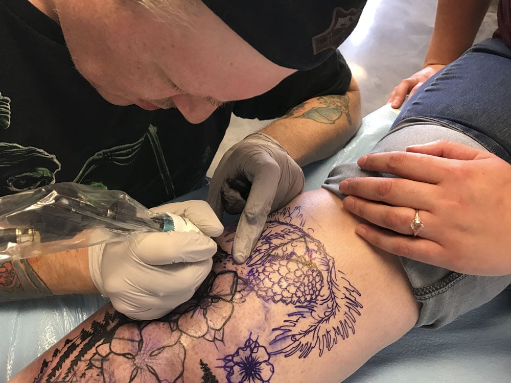 Tattoo Troubles How Does Tattoo Removal Work