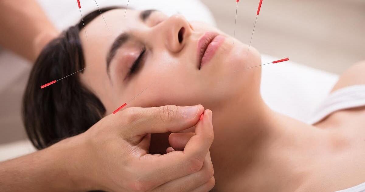 Acupuncture Can Make IVF More Comfortable, Study Says