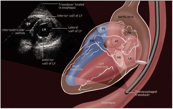 heart letters test hospital Local disease tool for heart diagnosing new has