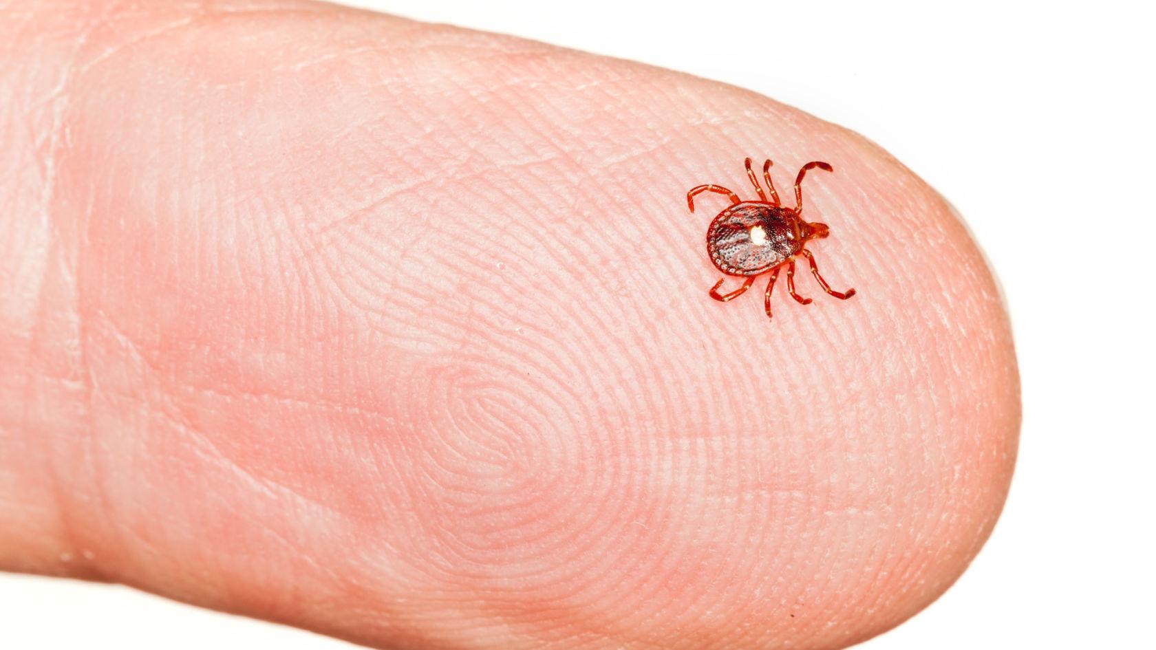 Eco Talk: What to know about Lyme disease and ticks - Vimarsana News