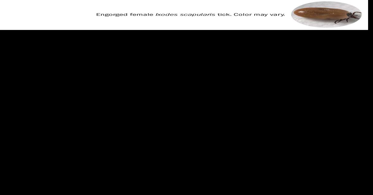 How to prevent Lyme disease and spread of tickborne illnesses