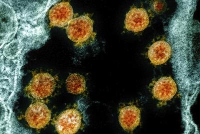 Virus Outbreak-Reinfection