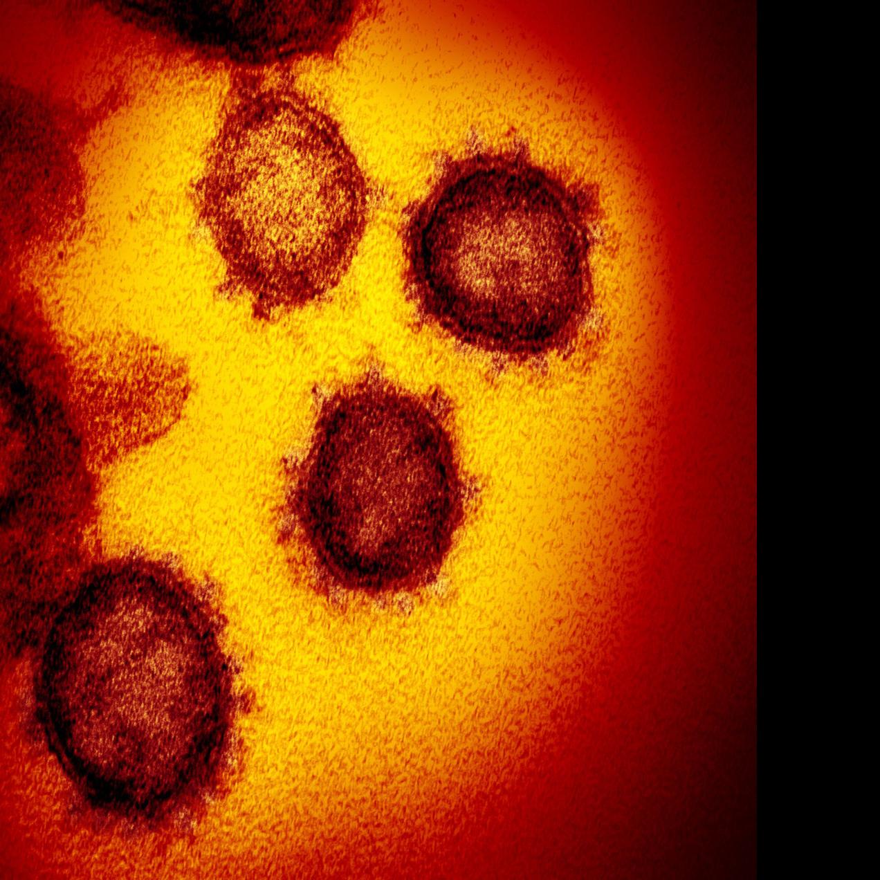 Questions About Coronavirus Cny Hospital Launches Triage Line Local News Auburnpub Com