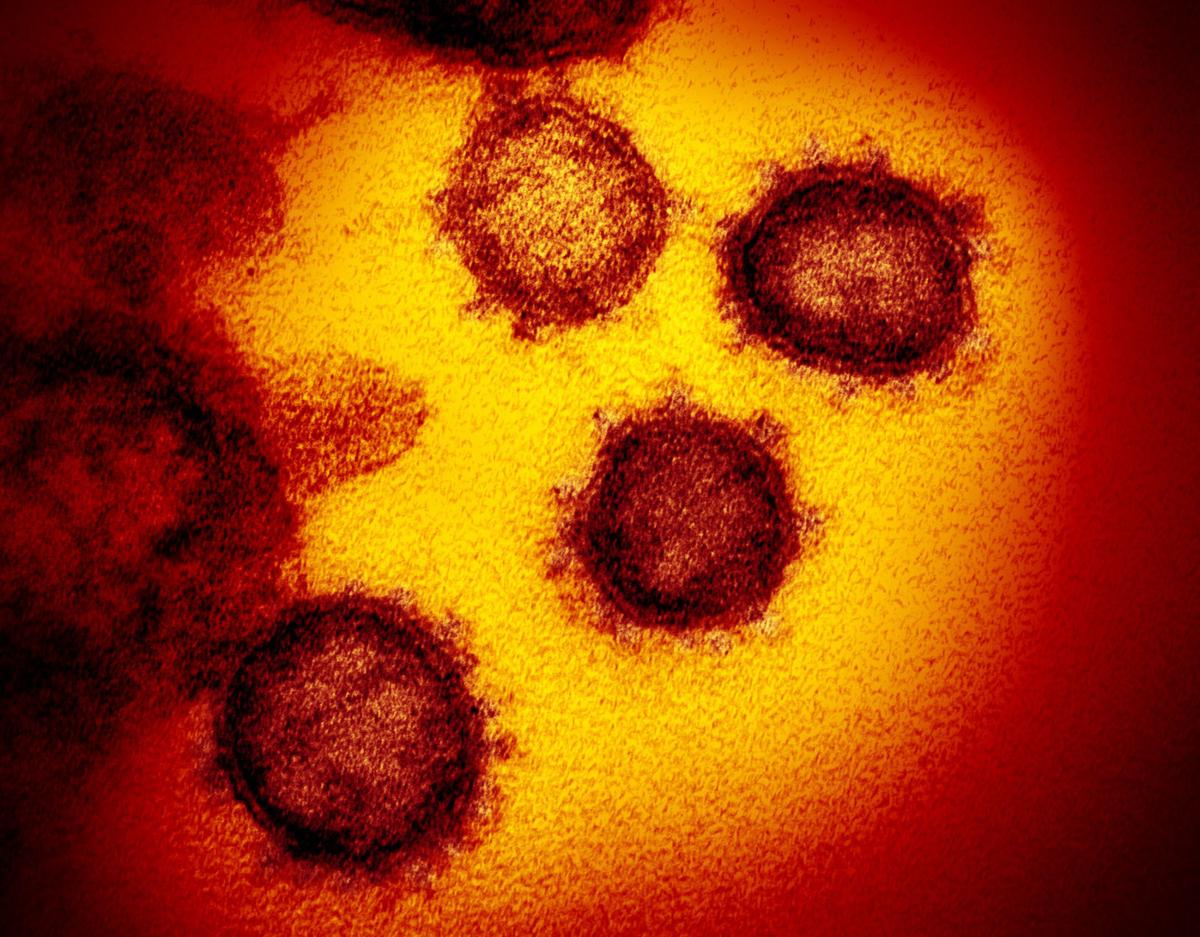 Increased Testing Leads To Error In Tompkins Coronavirus Data The Ithaca Voice
