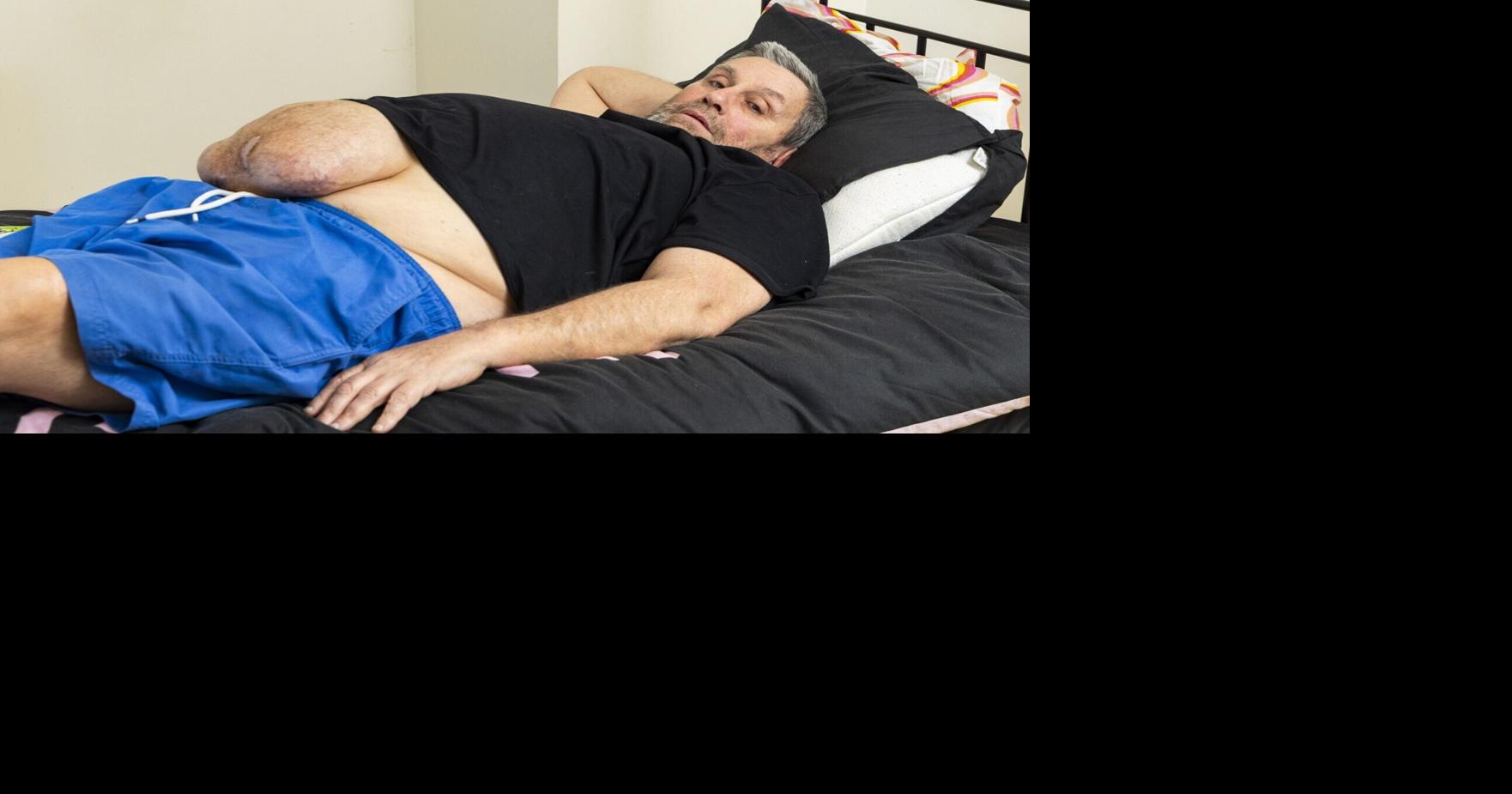 Man fundraising for surgery to remove watermelon-sized mass