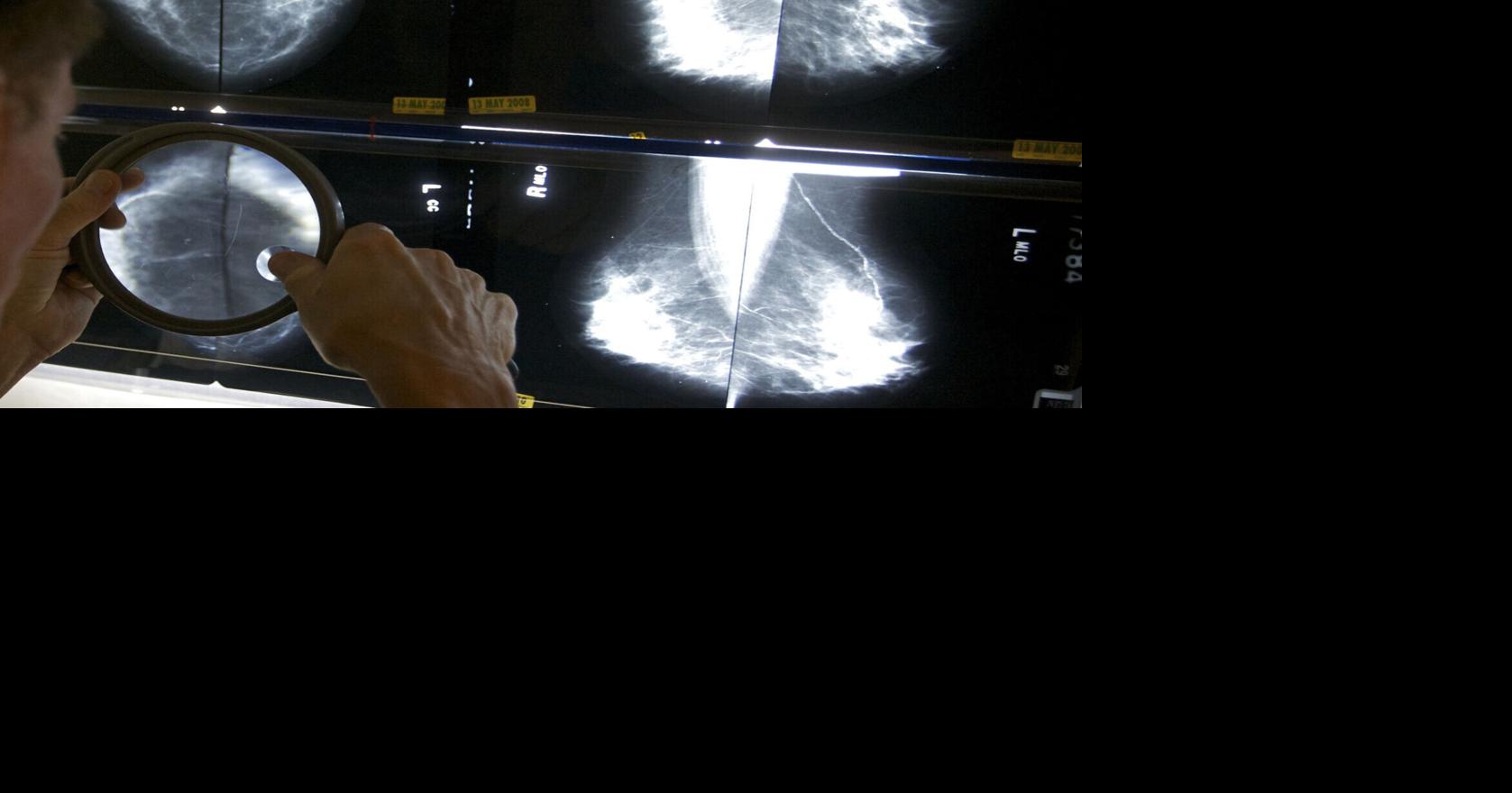 NAH oncologist leading workshop for Breast Cancer Awareness Month