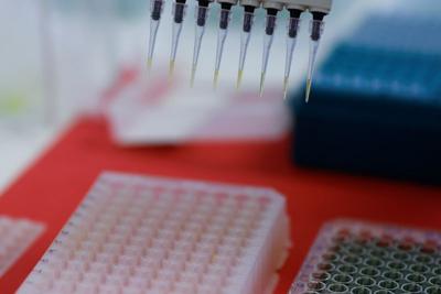 Brazil boosts bird flu defense to protect world's top chicken industry, in Campinas