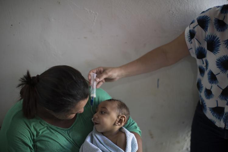 'Zika syndrome'