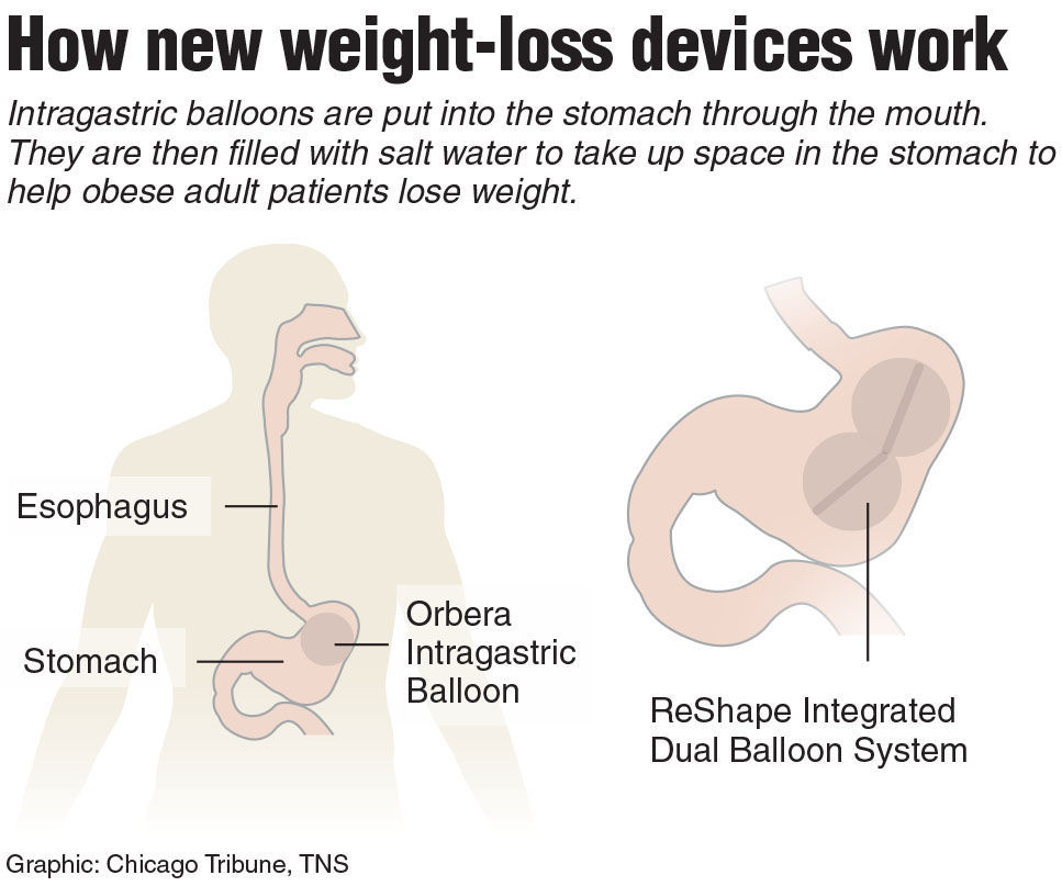 How to lose belly fat after giving birth with c-section photo 2