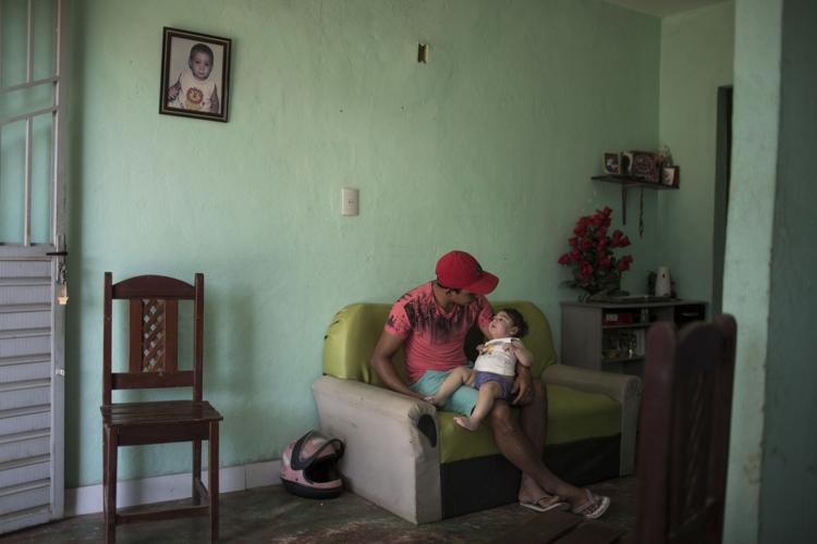 Brazil Zika Babies