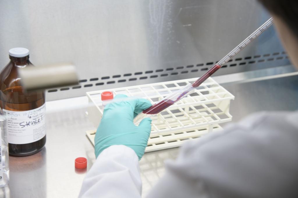 Bd Biomedomics Announce Launch Of Rapid Serology Test To Detect