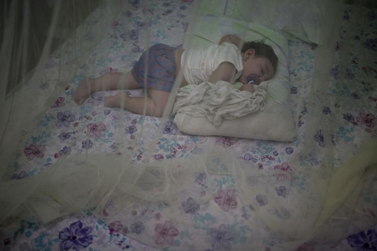 Brazil Zika Babies