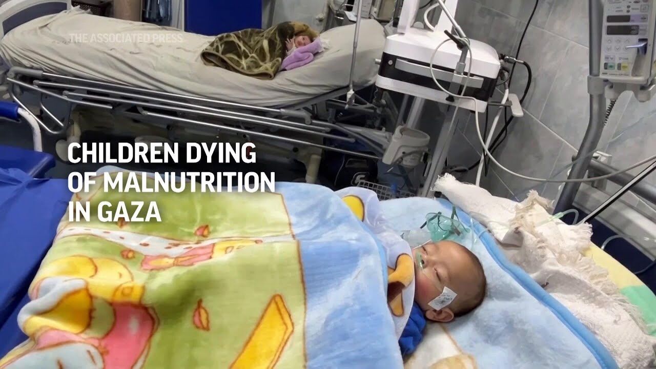 Children in Gaza are dying of malnutrition