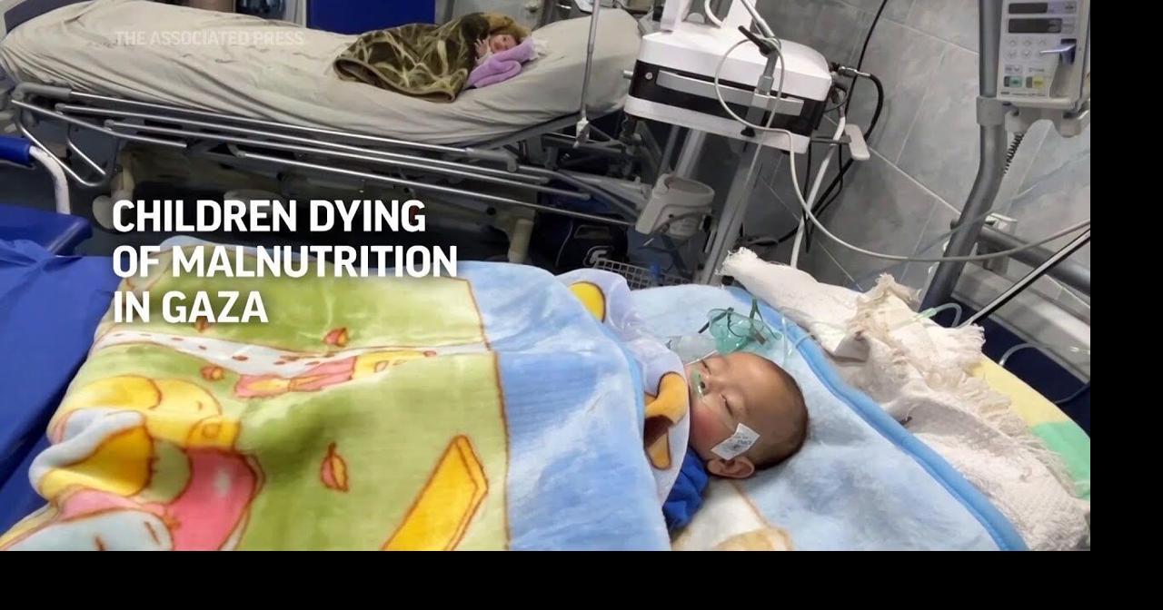 Children in Gaza are dying of malnutrition