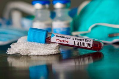 Wallpaper Study Ties Blood Type To Covid 19 Risk O May Help A Hurt Covid For Android Free