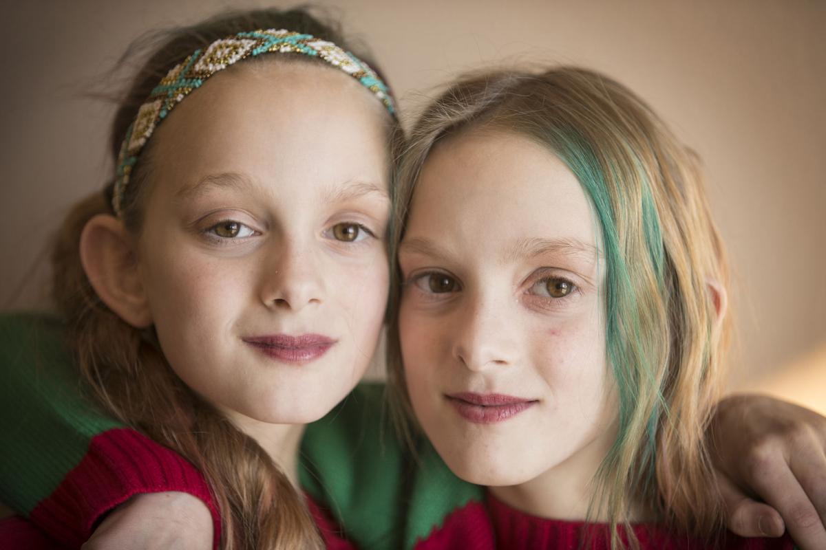 Born conjoined, N.D. girls beat surgical odds and are thriving at age ...