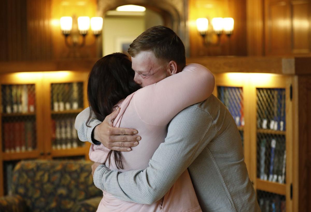 Tearful meeting for pair forever linked by face transplant