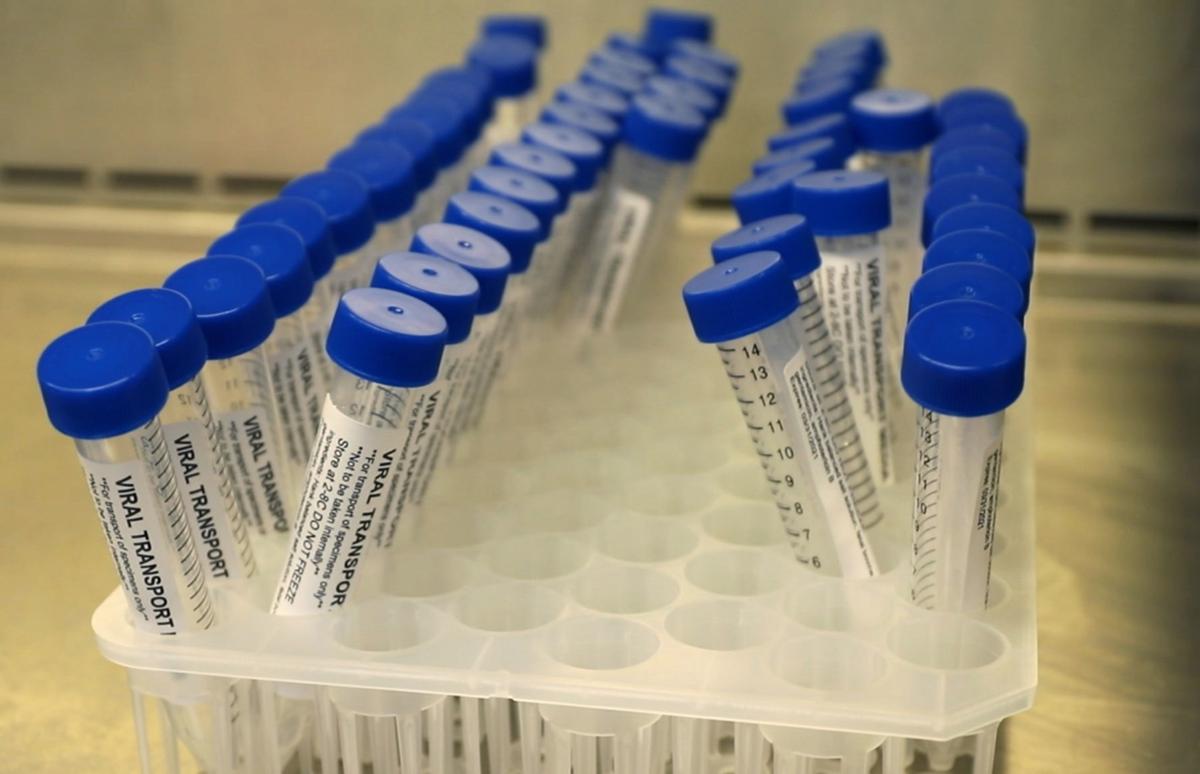 Billings hospitals make viral transport media for coronavirus testing