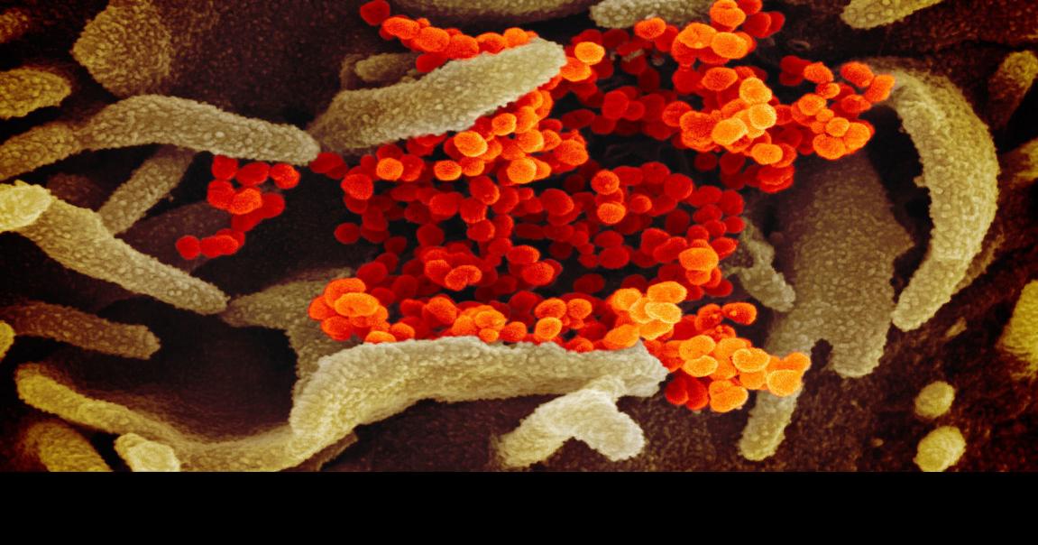 1 more Yellowstone County resident dies of COVID-19 illness