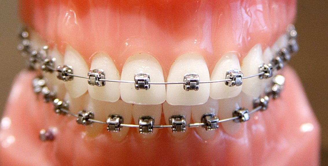 Billings orthodontist demonstrates technique to 4 Chinese peers Local