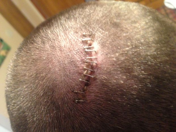 The Back Of Lane Herbert S Head Boys Basketball