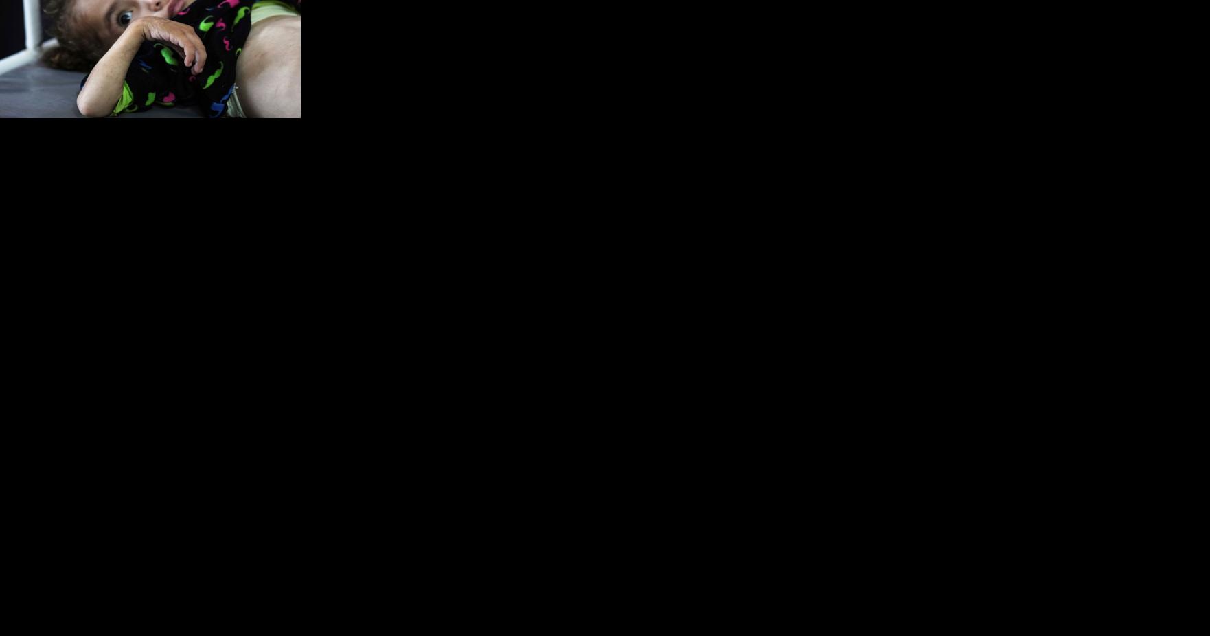 Gaza's main hospital is overwhelmed with children in pain from malnutrition