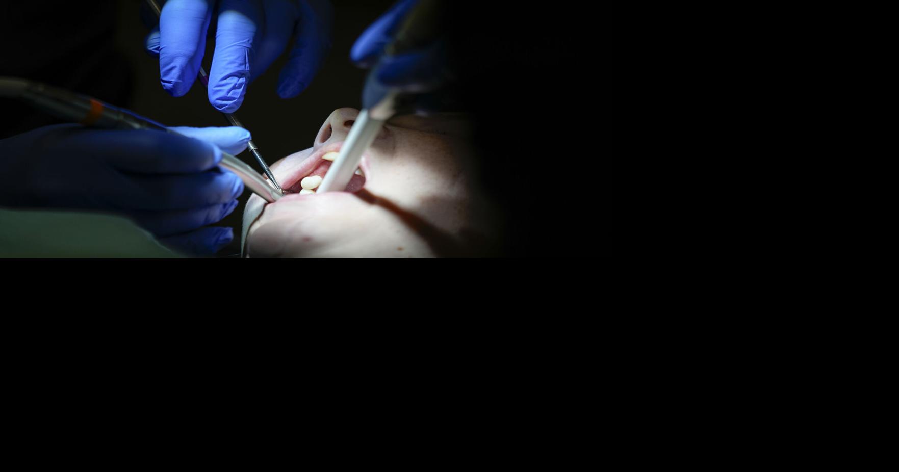 Indian Health Service to phase out use of dental fillings containing mercury by 2027