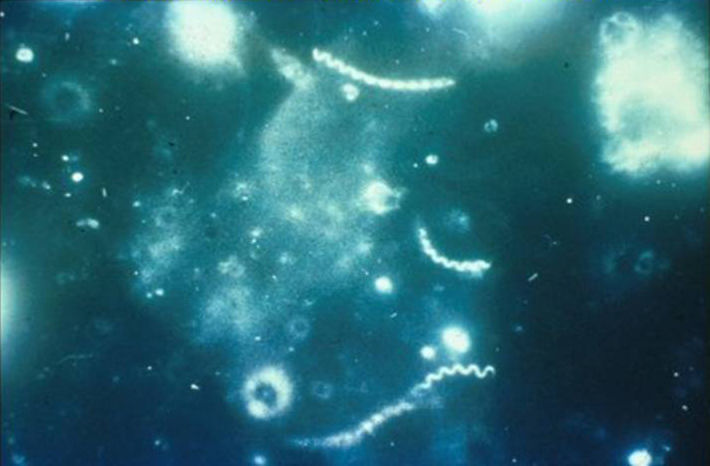 Treponema pallidum