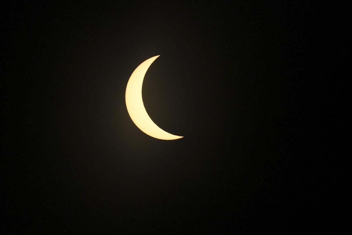 So you looked at the eclipse without safety glasses. What should you do