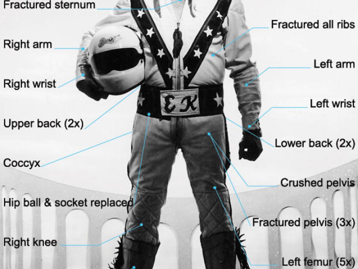 How Many Bones Did Evel Knievel Break Montana News Billingsgazette Com How Many Bones Did Evel Knievel Break Montana News Billingsgazette Com