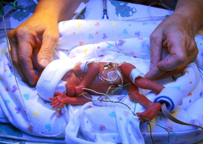 premature baby at 5 months