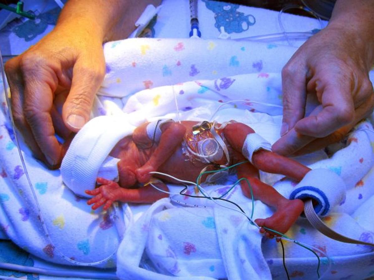 After 5 Months Premature Baby Weighs In At Nearly 8 Pounds Montana News Billingsgazette Com After 5 Months Premature Baby Weighs In At Nearly 8 Pounds Montana News Billingsgazette Com