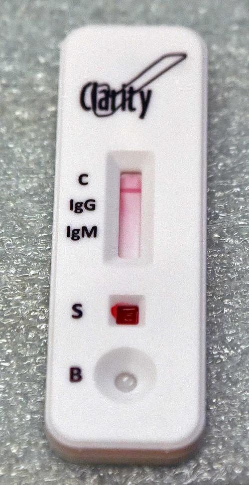 COVID-19 antibody test