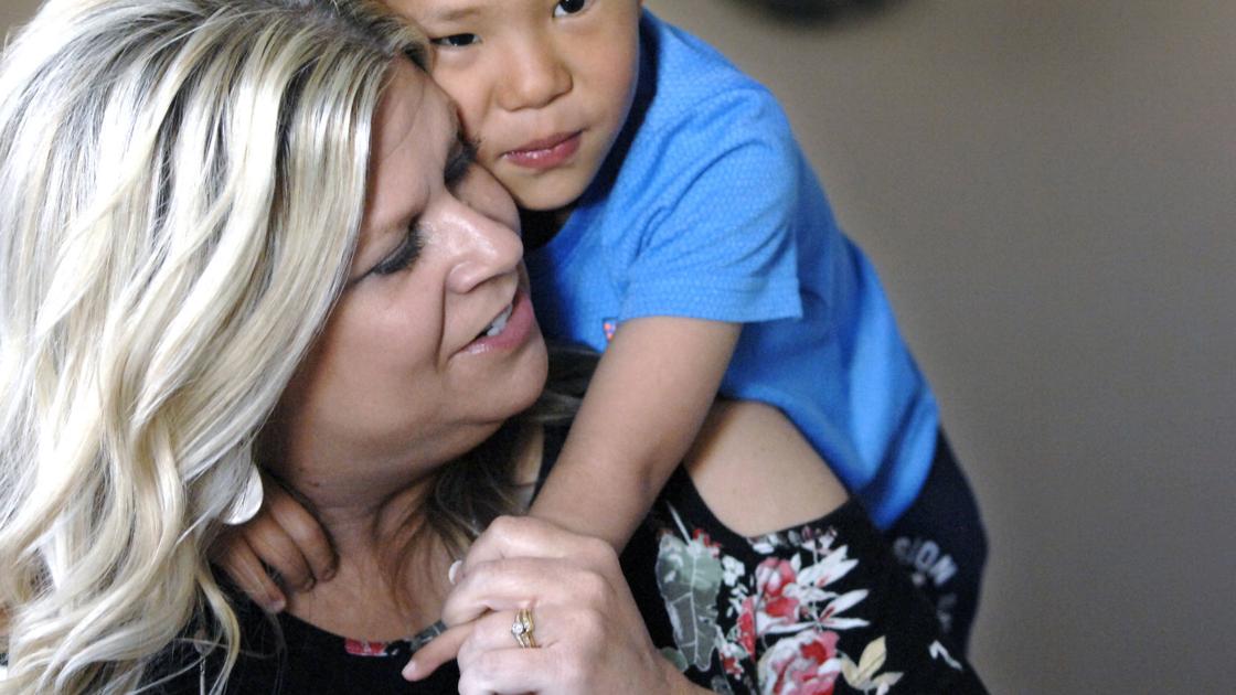 Boy born without thumbs, radius undergoes fourth surgery in Bismarck | Bismarck | bismarcktribune.com