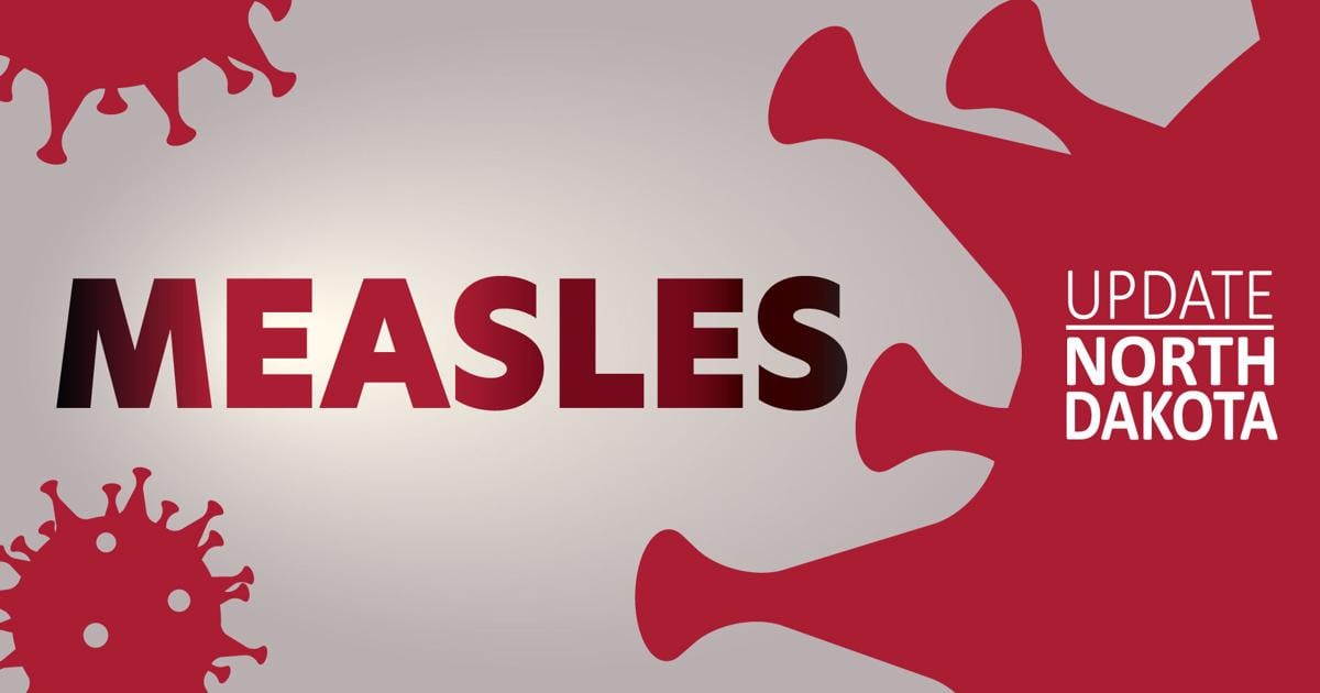 North Dakota measles outbreak expands to Dunn County