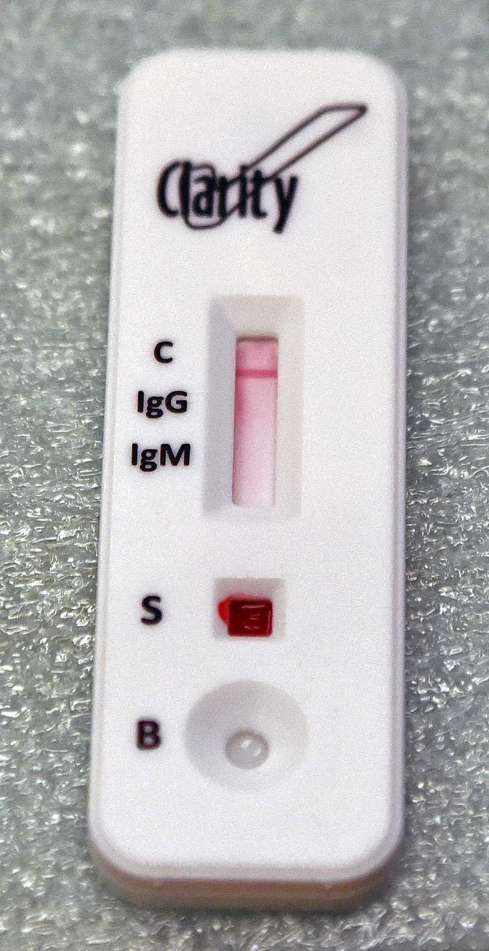 North Dakota COVID19 antibody testing awaits plan Health