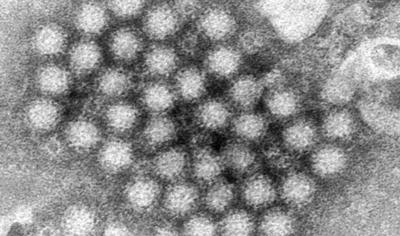 Norovirus from ADN