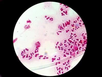 FDA Approves Two New Antibiotics to Treat Drug-Resistant Gonorrhea