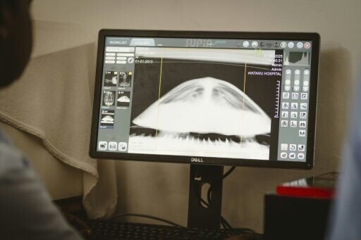 Kenya NGO saves turtles from nets, plastic and rising tides