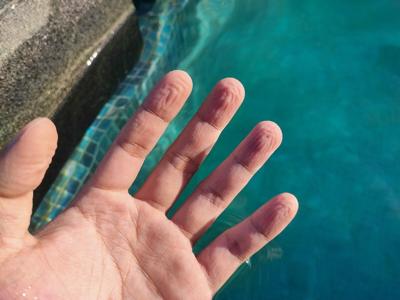 Got Pruney Fingers? Here's The Scientific Skinny To Explain It
