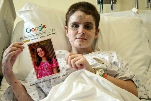 Bazzi's daughter Aseel shows a portrait of herself taken before she was gravely wounded in the Israeli strike