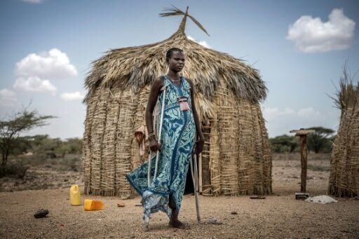 Rare bone-eroding disease ruining lives in Kenya's poorest county