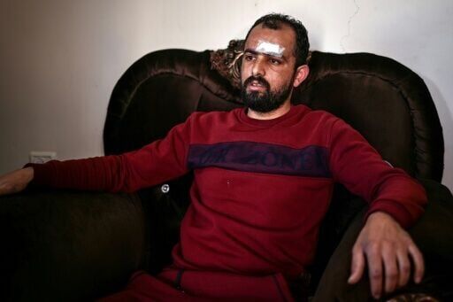 Muath al-Khatib was hospitalised after he said he was beaten with a club during an attack on his village by Israeli settlers