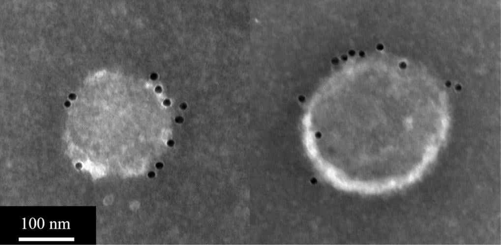 Universal flu vaccine derived from yeast could replace annual jabs, suggests study