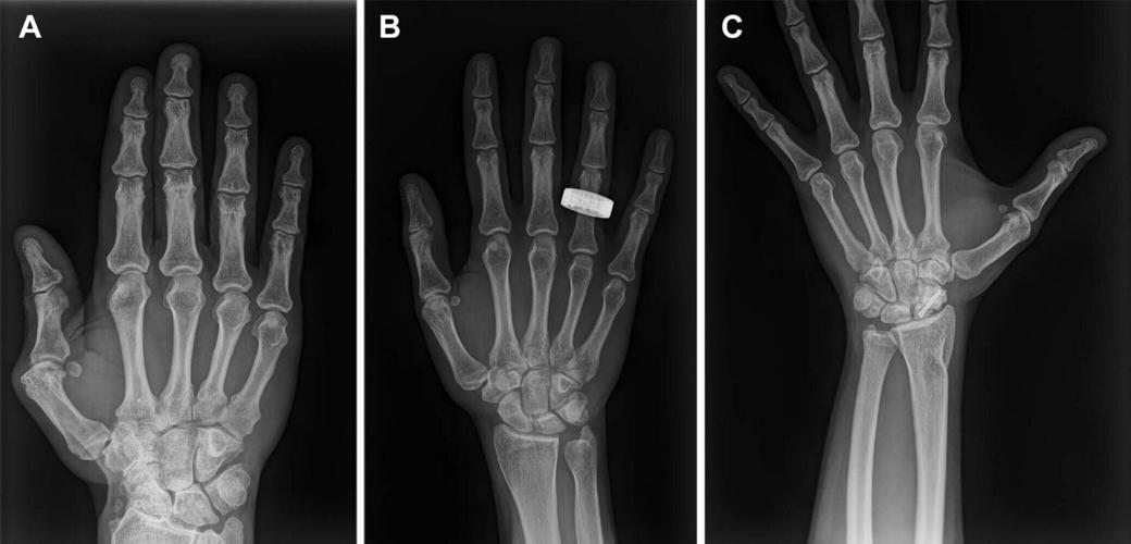 Medical X-rays taken in space for the first time