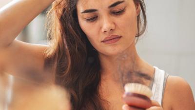 Can stress cause hair loss?