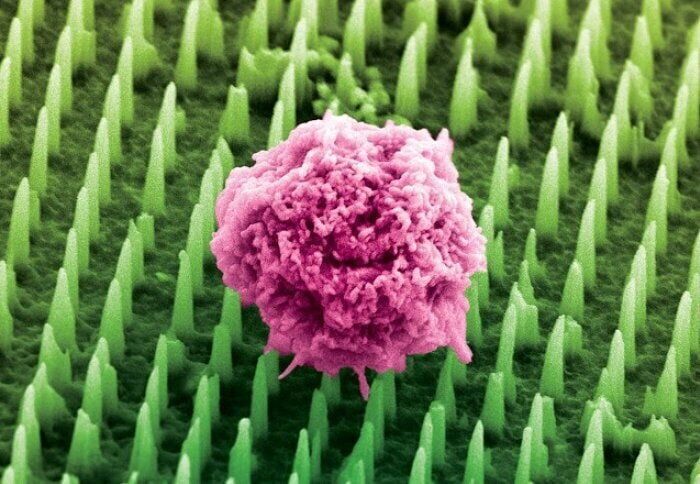Needles 1,000 times thinner than human hair “to replace painful cancer biopsies”
