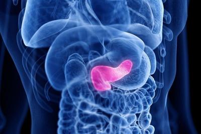 Risk Score Helps Predict Pancreatic Cancer Recurrence, Study Says