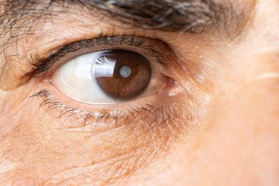Many Seniors Fear Cataract Surgery