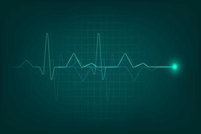 Ablation Best Treatment for Rapid Heartbeat in Heart Attack Survivors